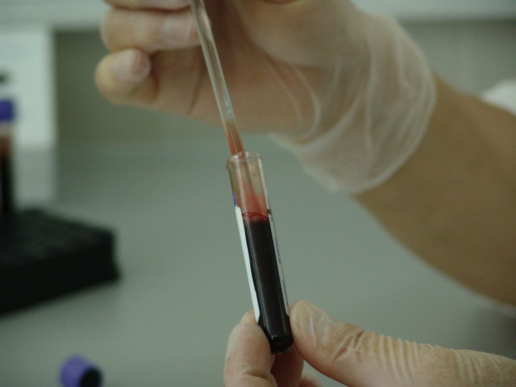 bio-hazardous waste - blood in a vial